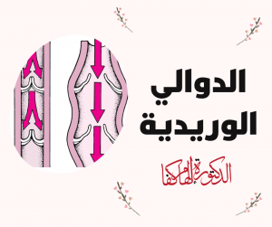 ما هو إلتهاب الأوردة السطحية أو الدوالي الوريدية – VARICOSES ؟